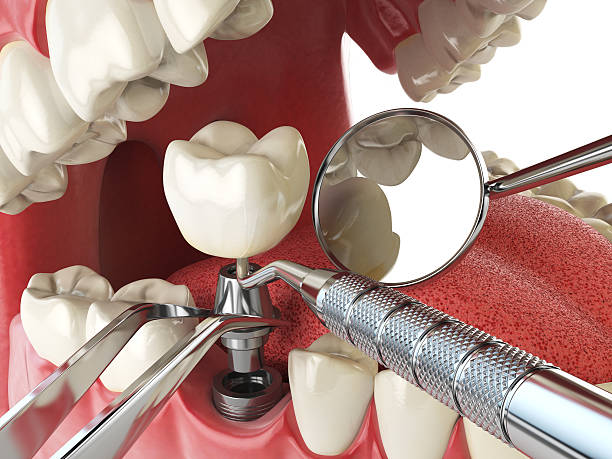 Best Emergency Dental Surgery in Badieville, LA