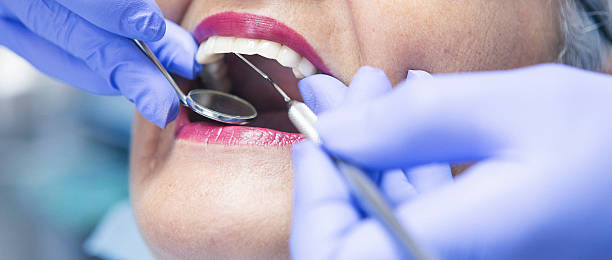 Best Emergency Tooth Extraction in Badieville, LA