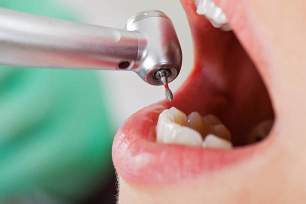 Best Emergency Treatment for Toothache in Badieville, LA